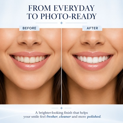 LOVILDS Tooth Polish - Instant White Smile